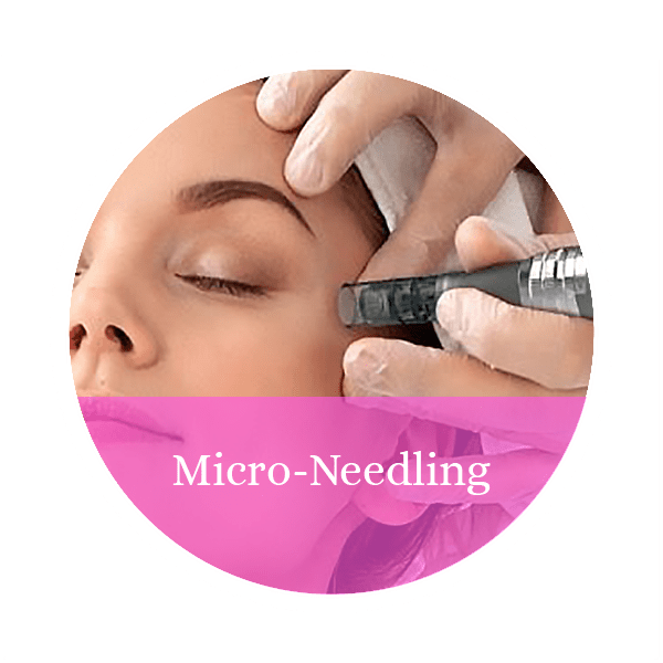 Microneedling Service