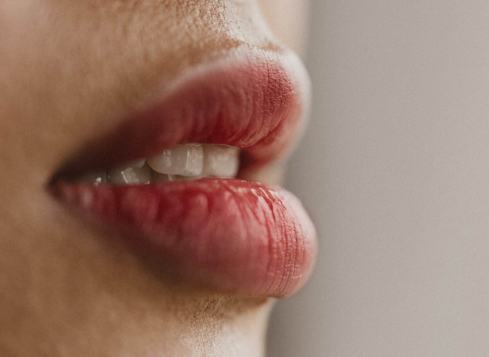 Lip Fill